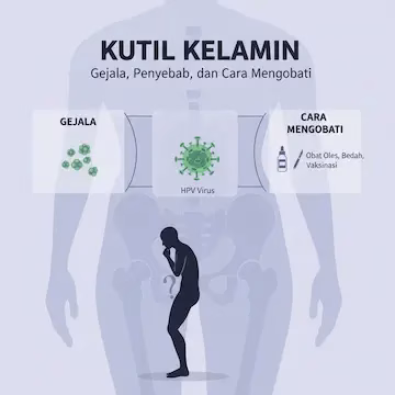 kutil kelamin